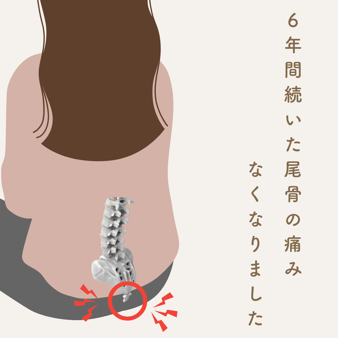 尾骨痛┊痛み止めではなく〝 骨格をととのえる 〟という選択